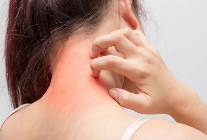 A viszketés a psoriasis egyik oka