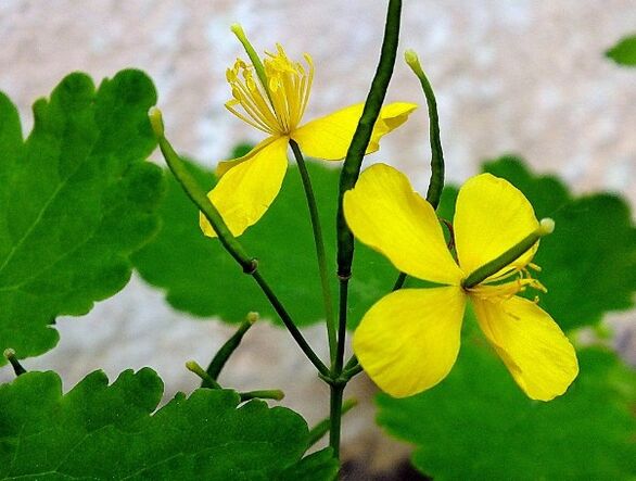 Celandine a psoriasis kezelésére